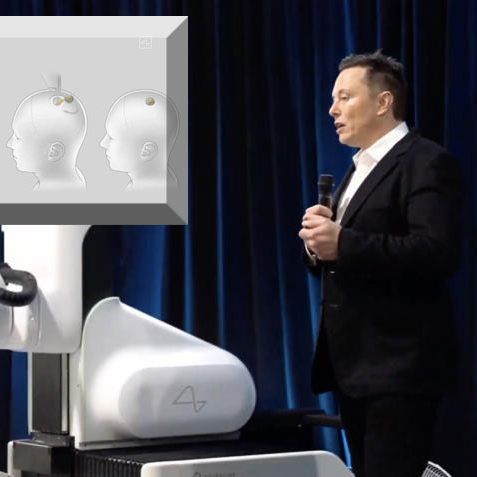Tech-Milliardär präsentierte Gerät seiner Firma Neurolink