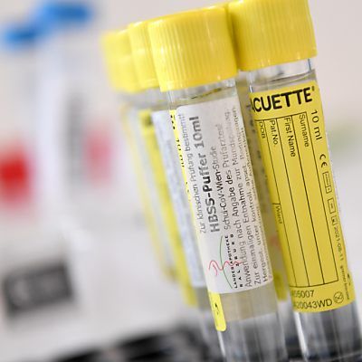 Die Zahl der Verstorbenen stieg nach Datenbereinigung um zehn auf 746