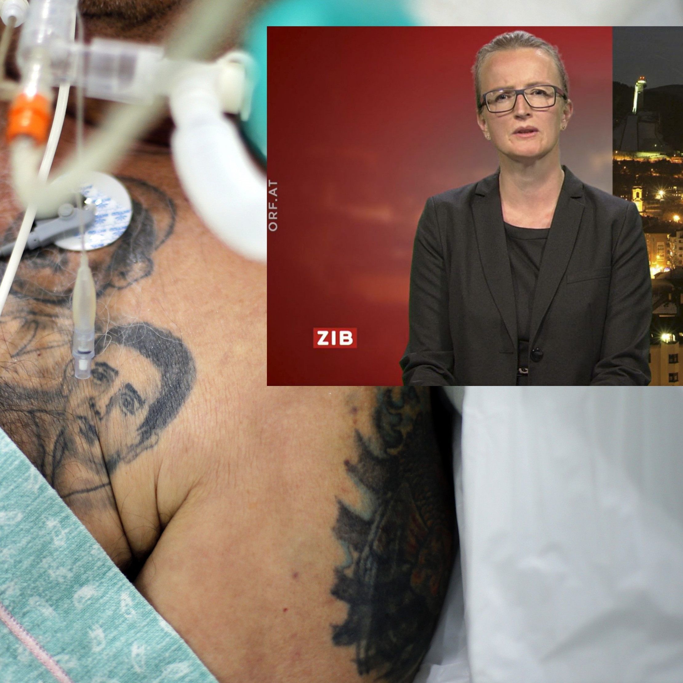 Ein Großteil der Lungenschäden geht nach einer Zeit zurück, behauptet nun eine Studie aus Innsbruck.