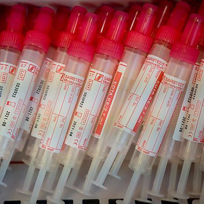 Die ersten Testtage sind fixiert