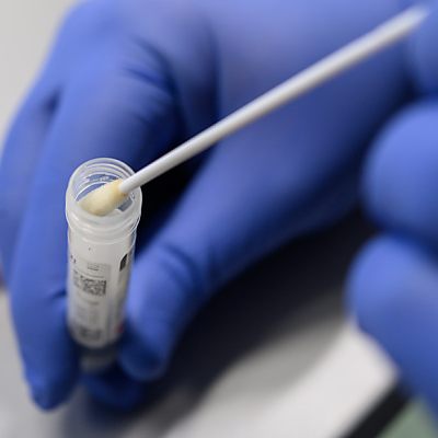 Am Wochenende ist die Zahl der Neuinfektionen meist geringer