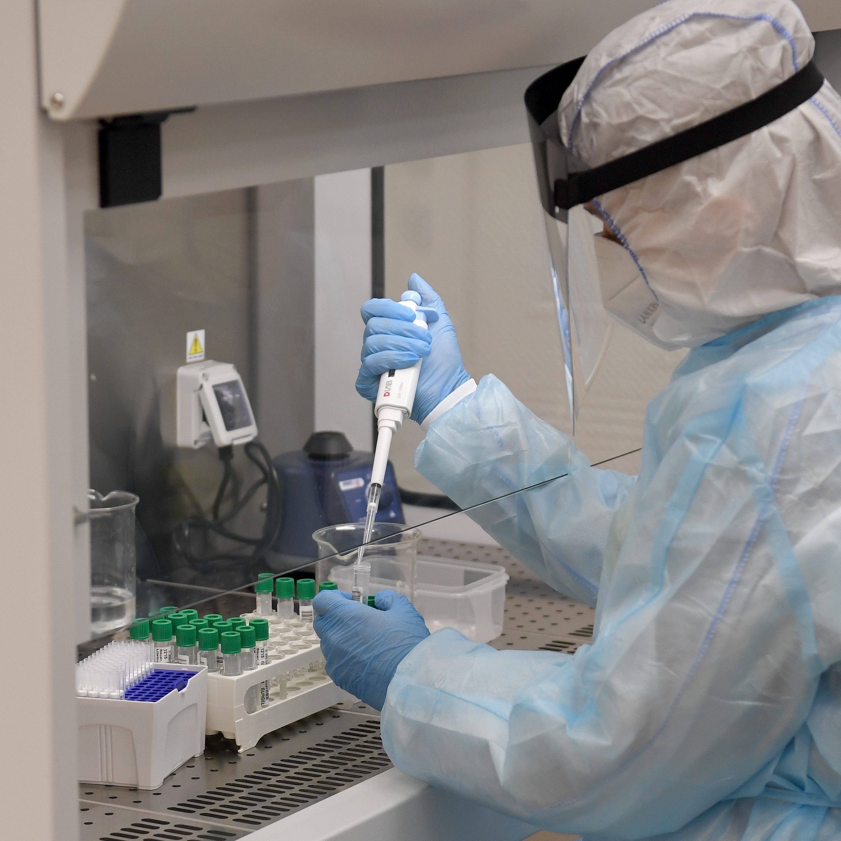 Anders als beim klassischen PCR-Test (Bild) sollen Grippe-Covid-Kombitests auch Influenza A und B nachweisen können