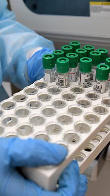 Proben-Röhrchen in einem Labor