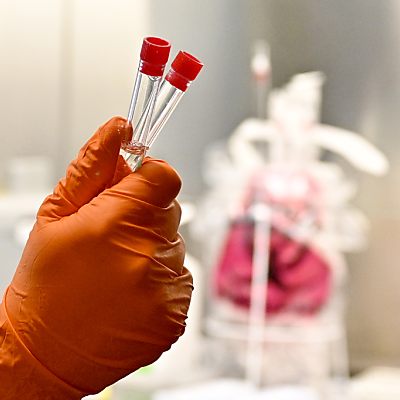 AGES bestätigt weitere südafrikanische Mutationsfälle in Tirol