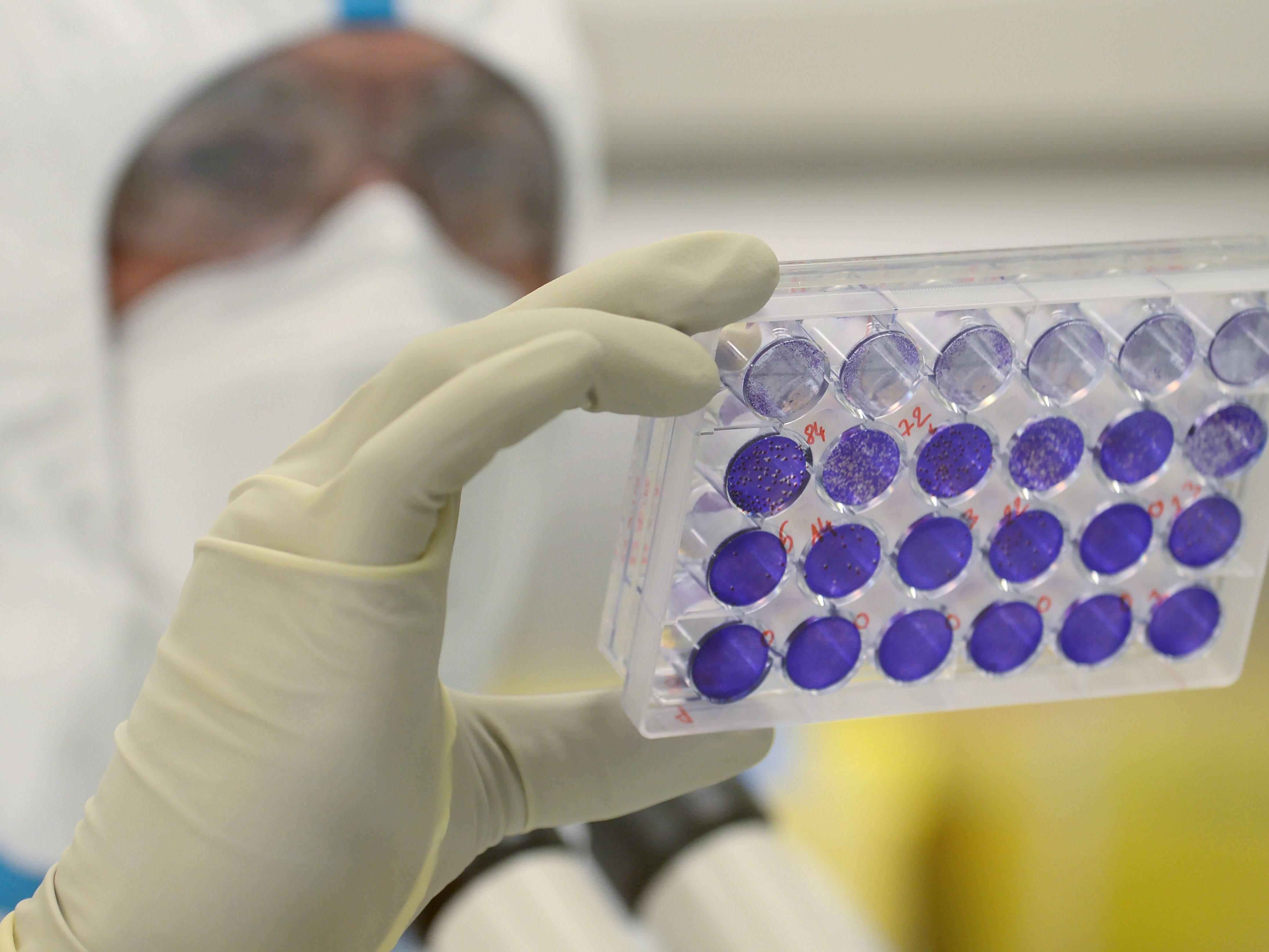 Französisch-österreichisches Biotechunternehmen testet "VLA2001" in Großbritannien. Französisch-österreichisches Biotechunternehmen testet "VLA2001" in Großbritannien.