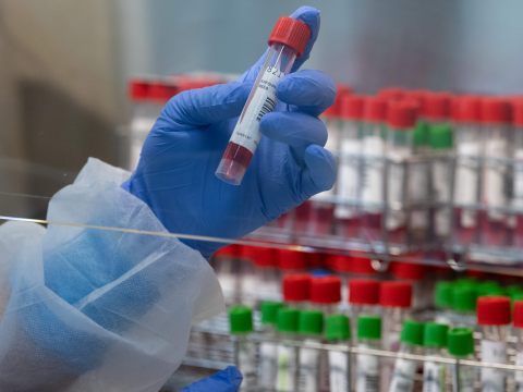 1.190 Coronavirus-Neuinfektionen wurden am Sonntag gemeldet.