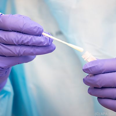 Innerhalb von 24 Stunden mehr positive Tests als wieder Genesene