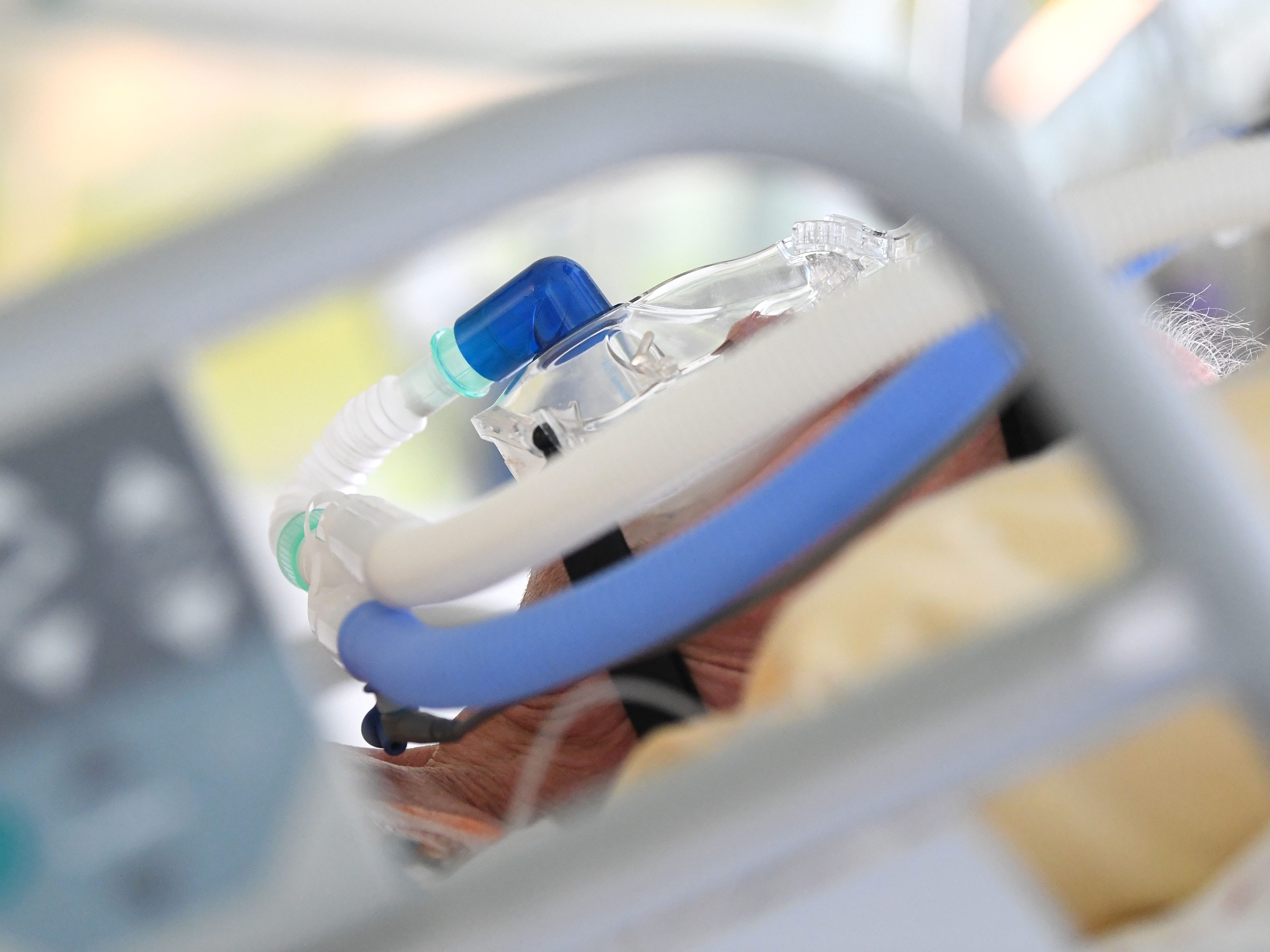 Für viele Corona-Intensivpatienten ist die sofortige Rückkehr ins Alltagsleben unmöglich. Für viele Corona-Intensivpatienten ist die sofortige Rückkehr ins Alltagsleben unmöglich.