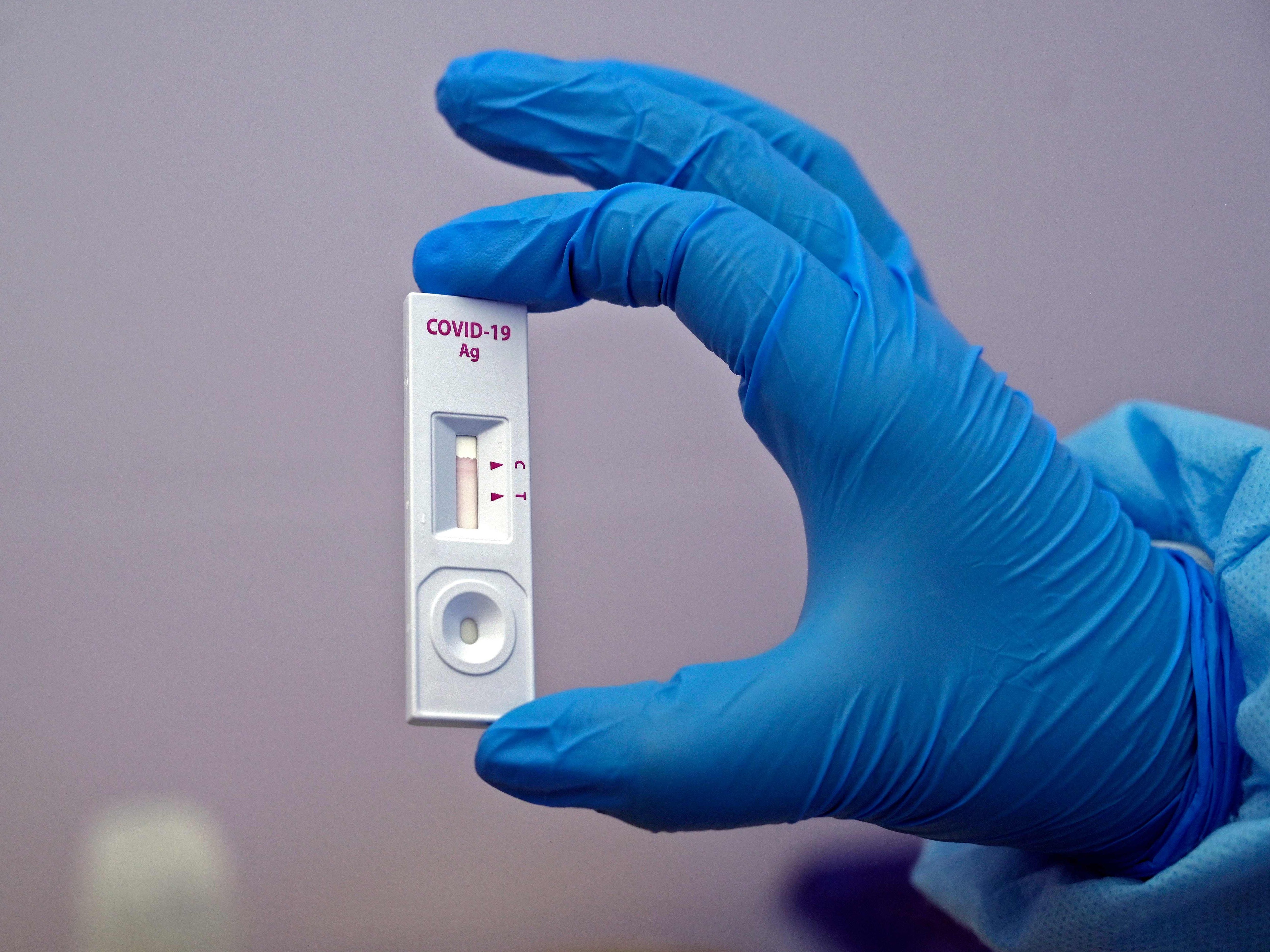 573 Personen in Vorarlberg sind aktuell mit dem Virus infiziert. 573 Personen in Vorarlberg sind aktuell mit dem Virus infiziert.