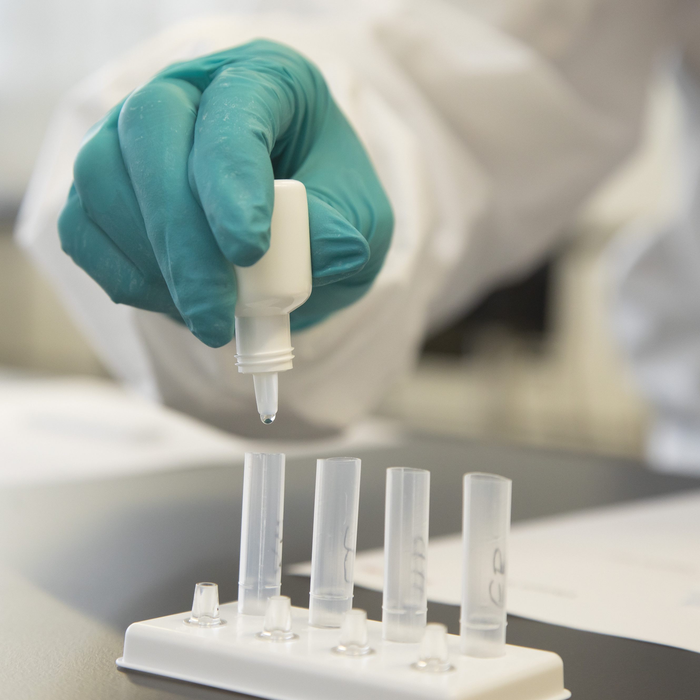 19 Neuinfektionen waren am Mittwochmittag zu verzeichnen.