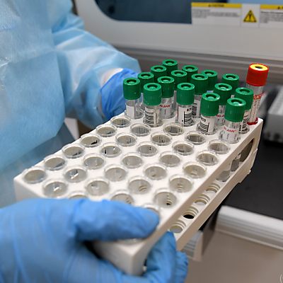 Sieben-Tage-Schnitt derzeit bei 3.187 positiven Testergebnissen