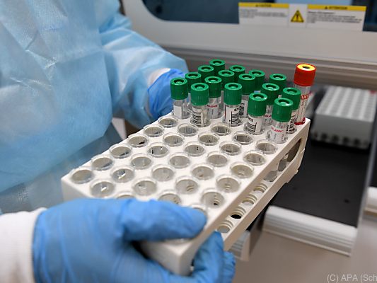 Sieben-Tage-Schnitt derzeit bei 3.187 positiven Testergebnissen Sieben-Tage-Schnitt derzeit bei 3.187 positiven Testergebnissen