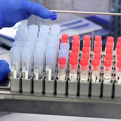 Auch Anteil positiver PCR-Tests angestiegen