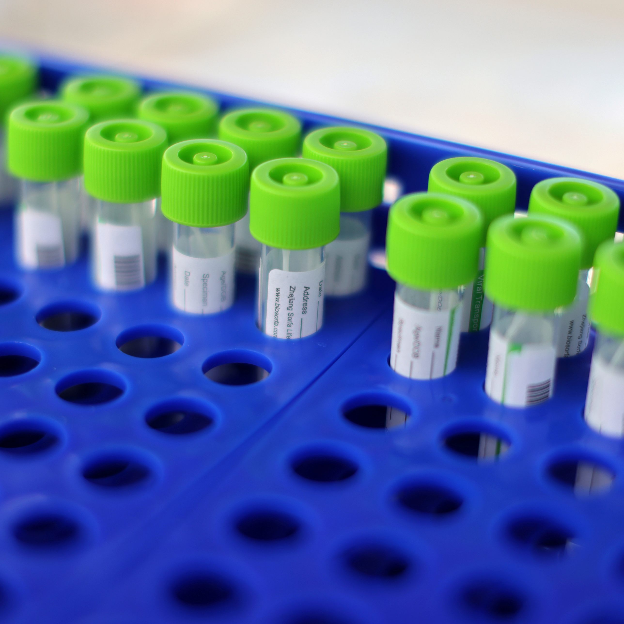 Zahl der aktiv positiv Getesteten erhöht sich leicht auf 395.