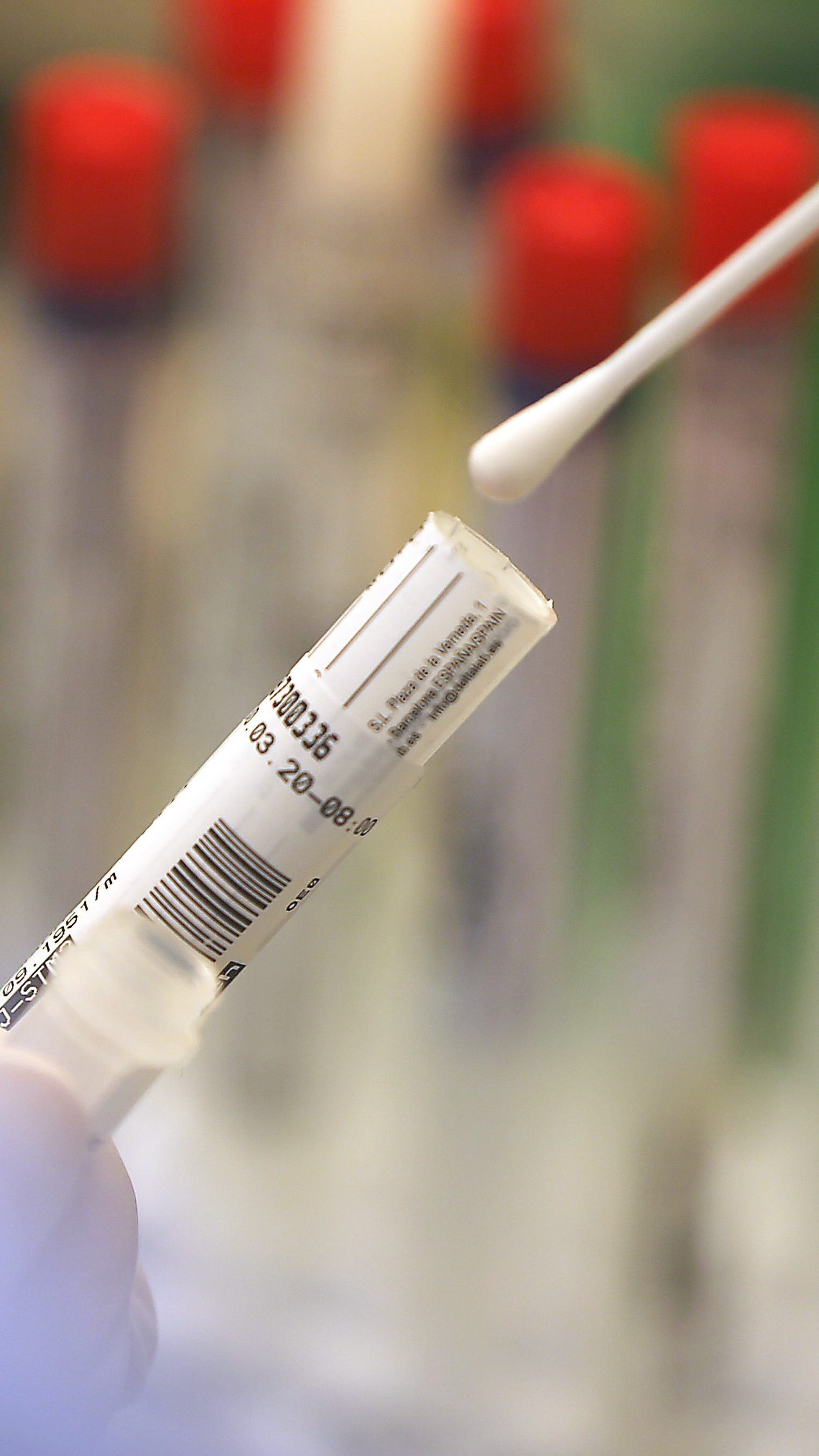 Immer öfter wird nach Antikörper-Tests gefragt.