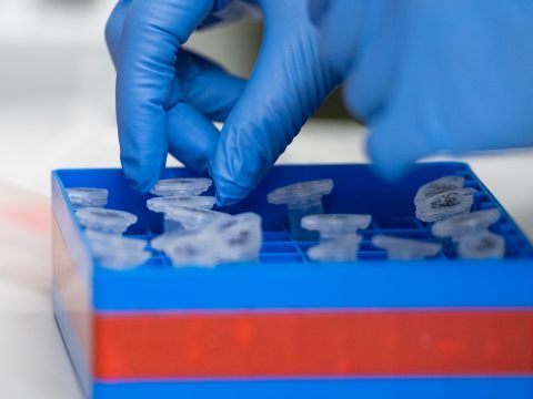 Apeiron: Wiener Unternehmen meldet signifikante Reduktion der Tage mit mechanischer Beatmung. Apeiron: Wiener Unternehmen meldet signifikante Reduktion der Tage mit mechanischer Beatmung.