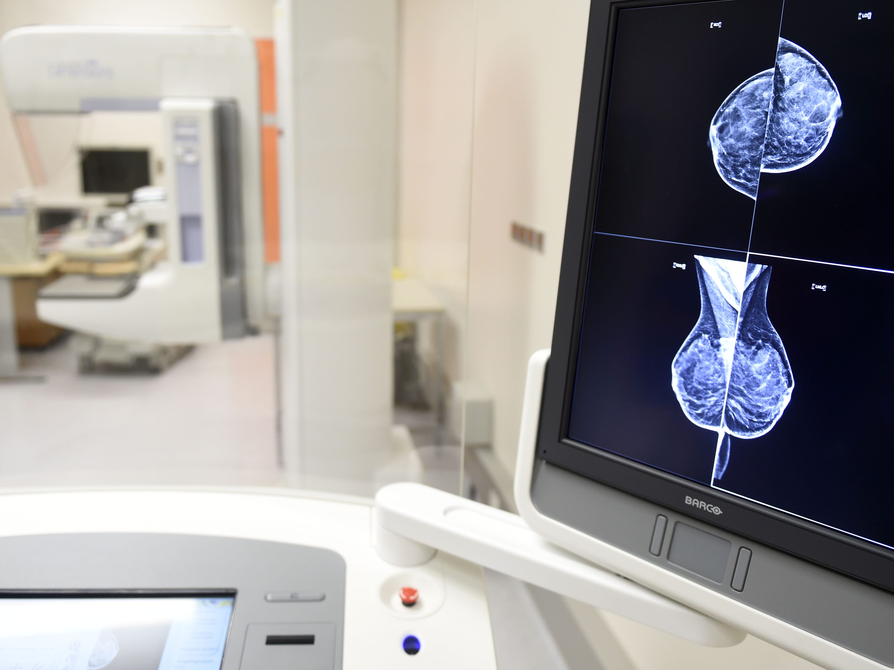 Die Zahl der Mammographien ist zurückgegangen. Die Zahl der Mammographien ist zurückgegangen.