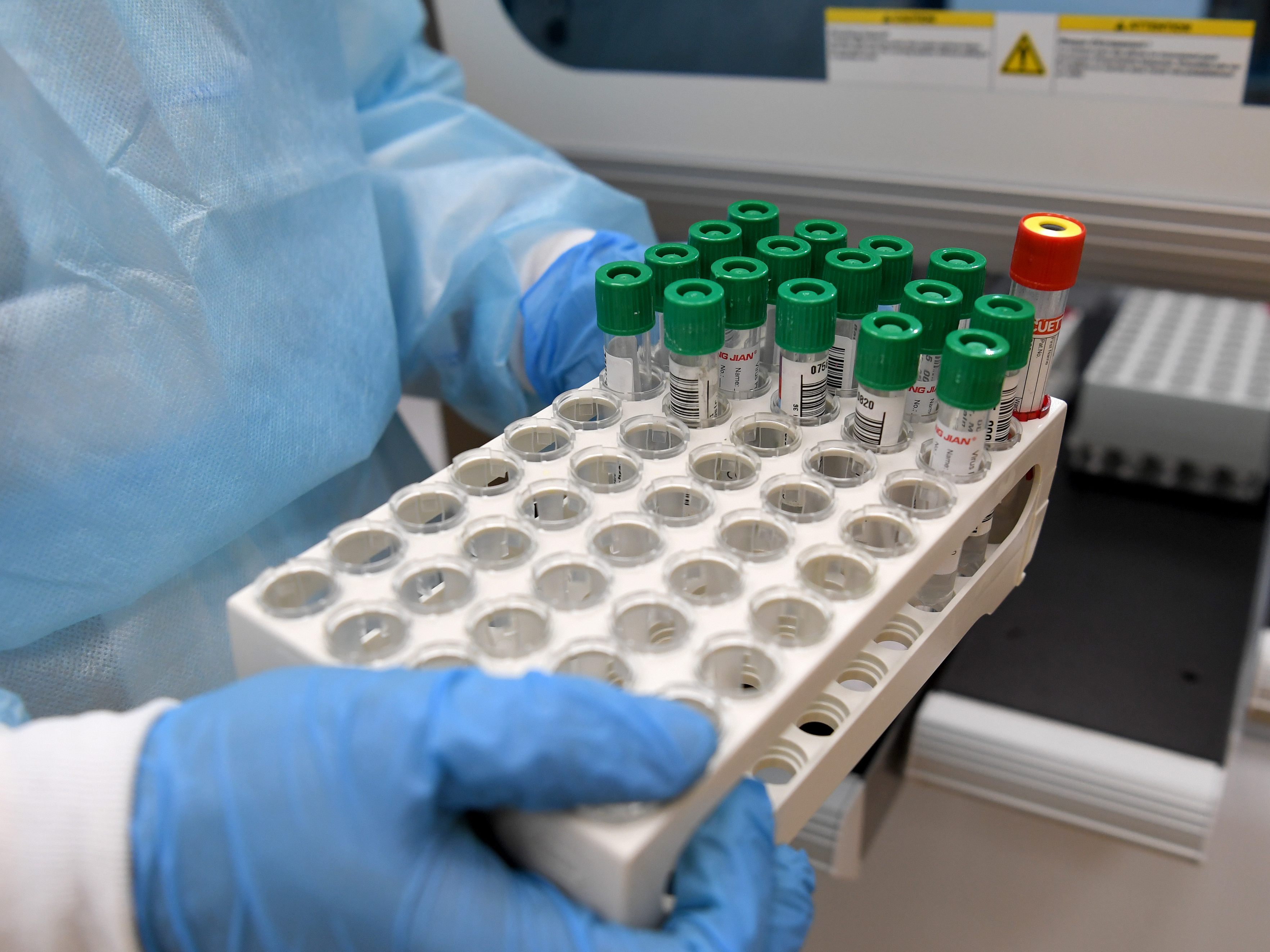 Lifebrain hat bisher über 200.000 PCR-Tests für die Stadt Wien ausgewertet. Lifebrain hat bisher über 200.000 PCR-Tests für die Stadt Wien ausgewertet.