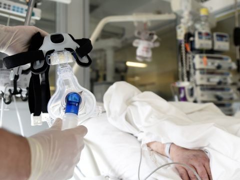 Die Sterblichkeit der SARS-CoV-2-Positiven ist im Pandemieverlauf in allen Altersgruppen gesunken Die Sterblichkeit der SARS-CoV-2-Positiven ist im Pandemieverlauf in allen Altersgruppen gesunken