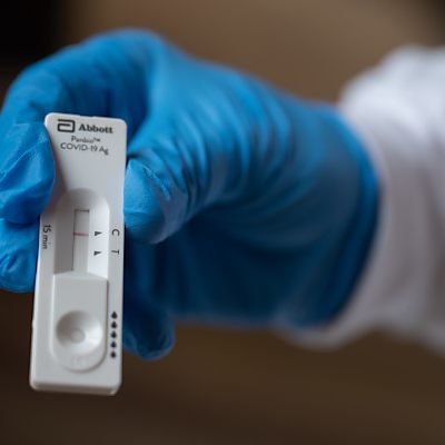 302.593 zusätzliche Tests seit Freitag eingemeldet