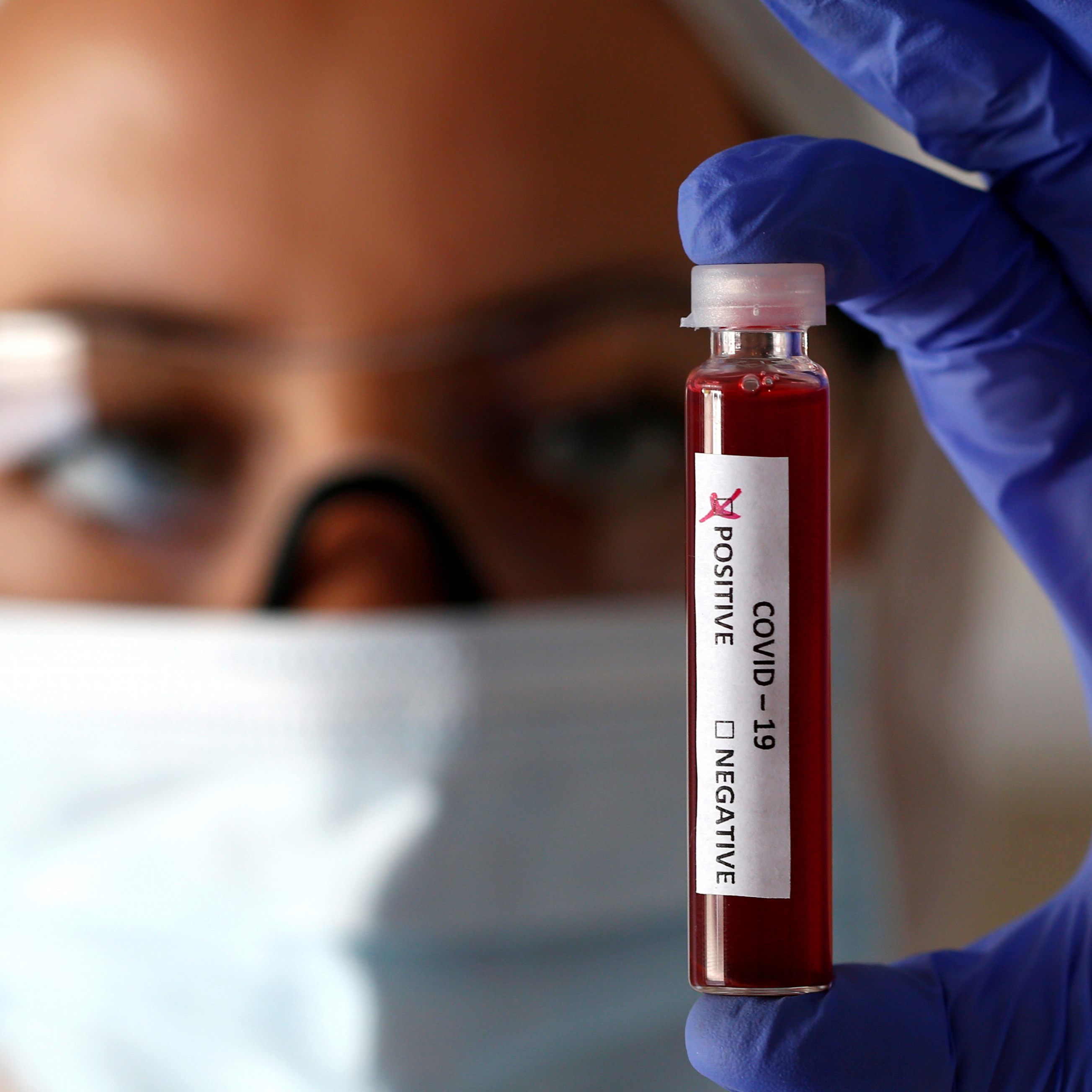 Aktuell gelten 1.328 Personen als Corona-positiv.