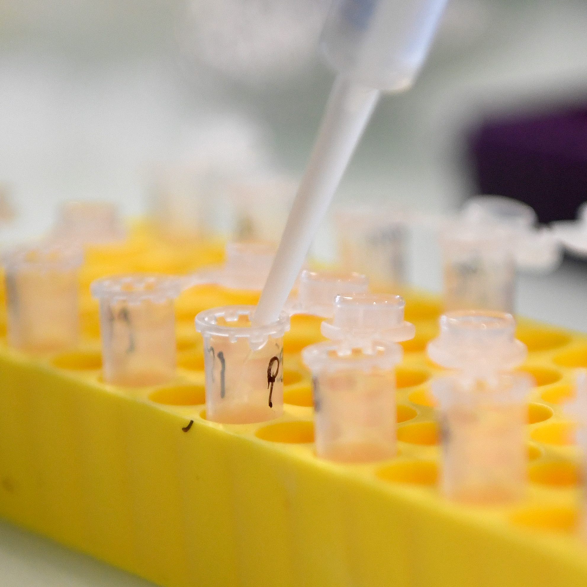 46 Neuinfektionen verzeichnete das Dashboard des Landes in Vorarlberg.