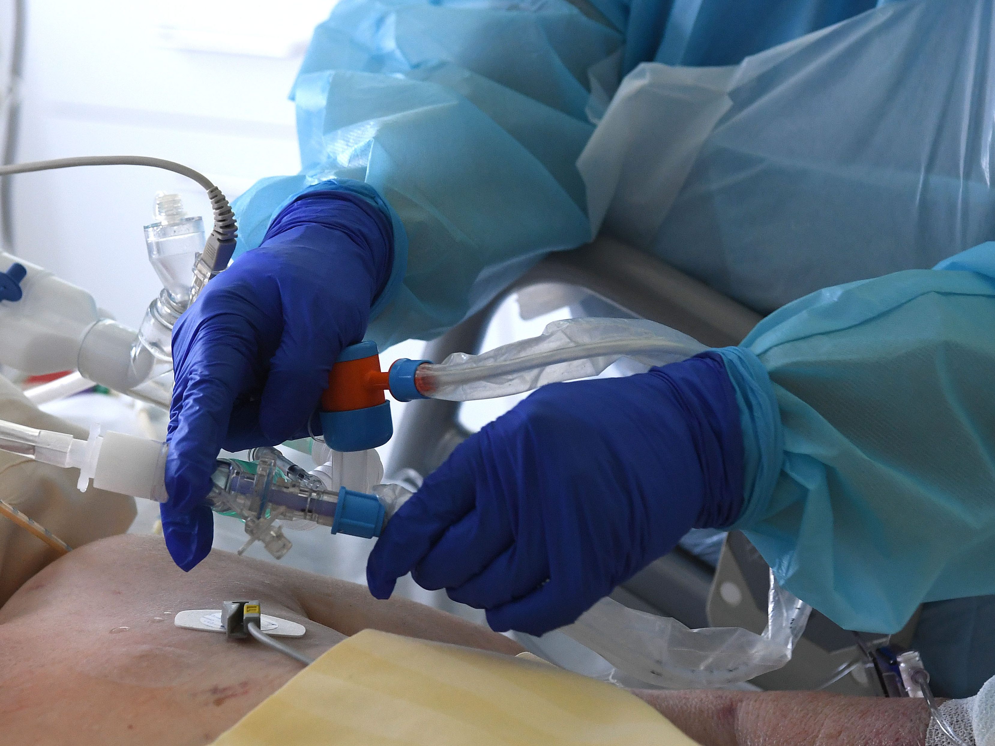 Die Zahl der Intensivpatienten in Wien ist erneut leicht zurückgegangen. Die Zahl der Intensivpatienten in Wien ist erneut leicht zurückgegangen.