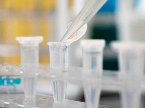 70 Neuinfektionen und 20 Intensivpatienten im Burgenland.