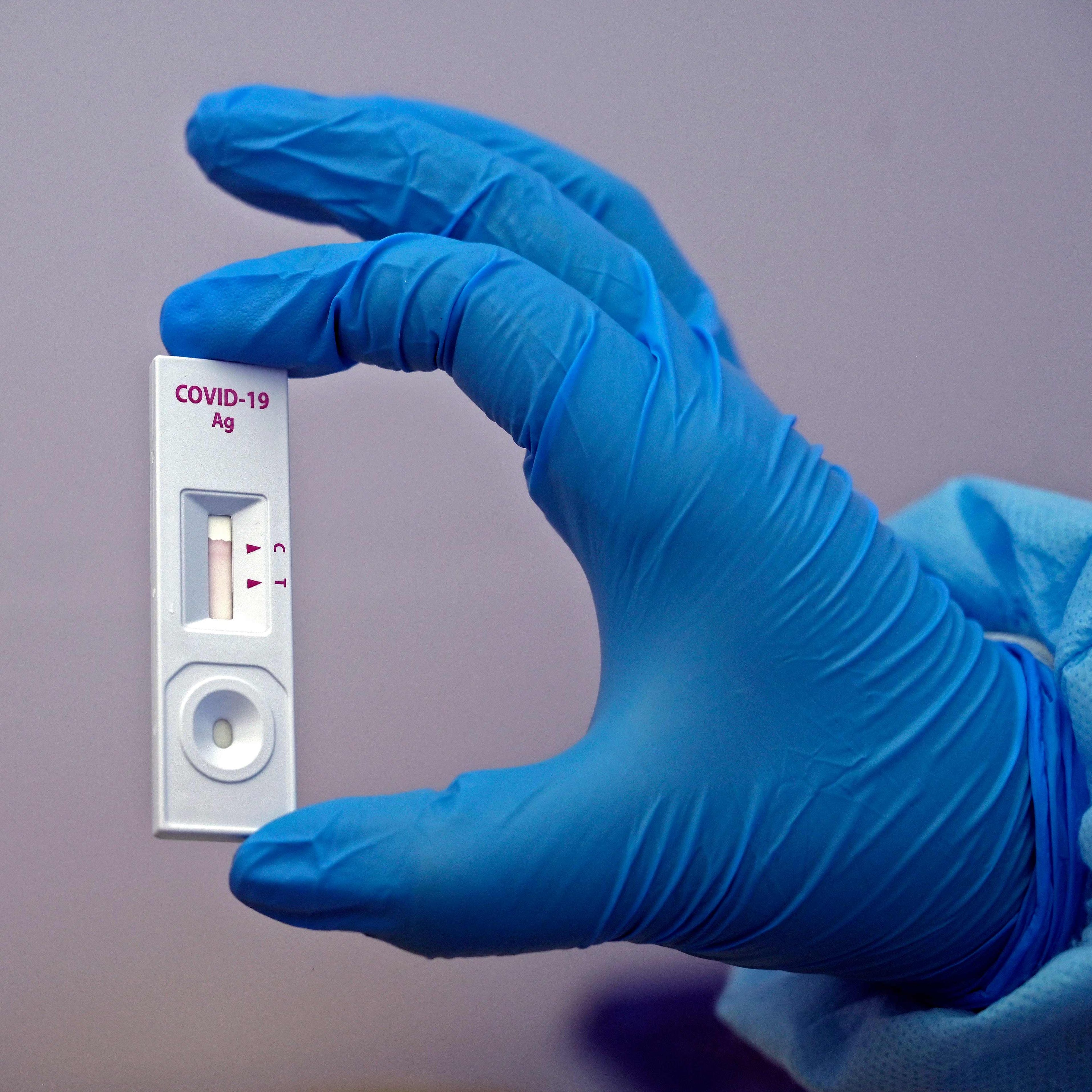 39 Neuinfektionen wurden bis Mittwochmittag verzeichnet.