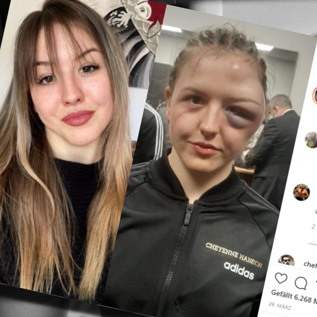 Cheyenne Hanson zeigt auf ihrem Instagram-Kanal ein Vorher-Nachher Foto.