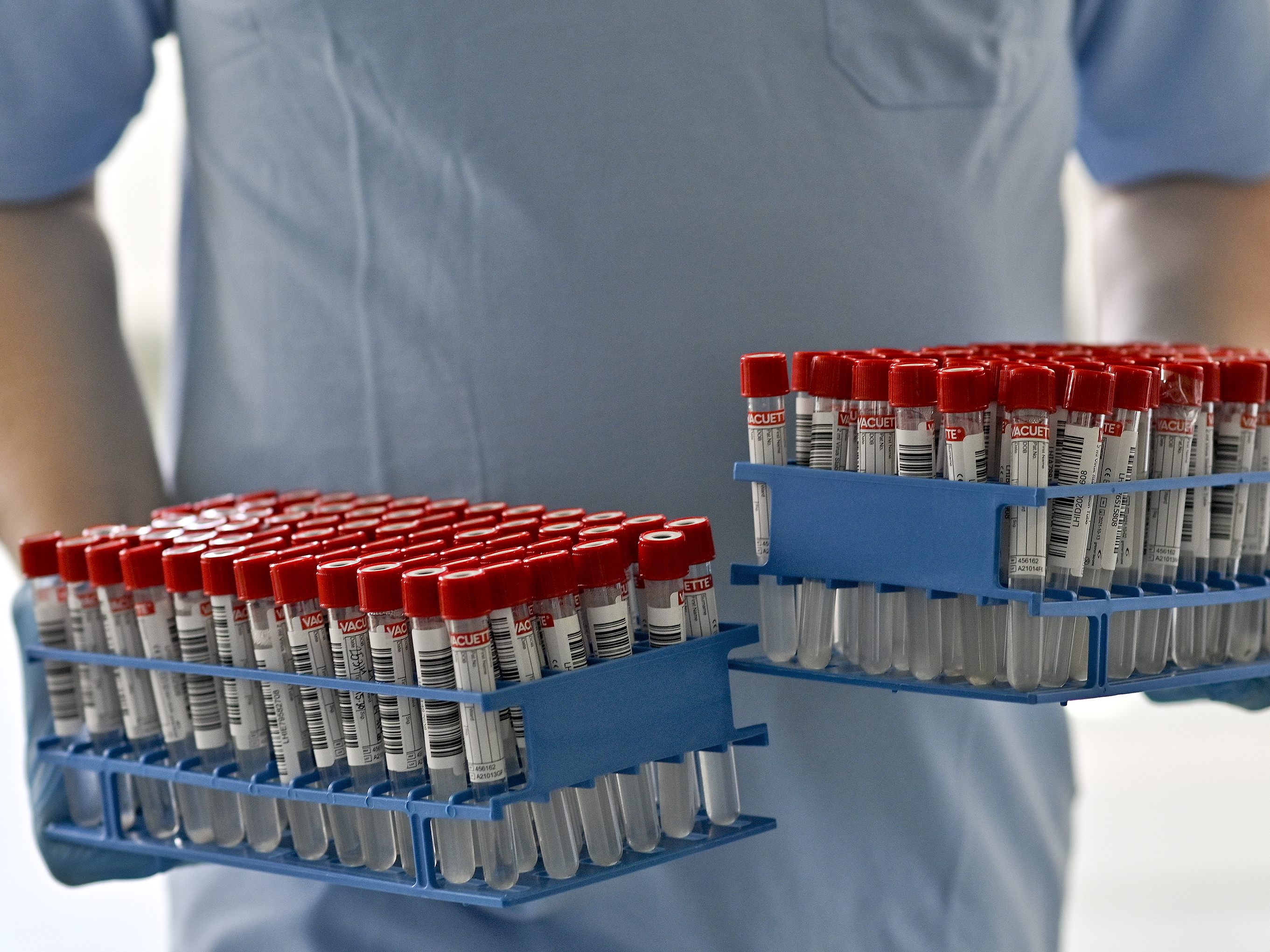 Das Labor soll rund 300.000 Tests pro Tag auswerten können.