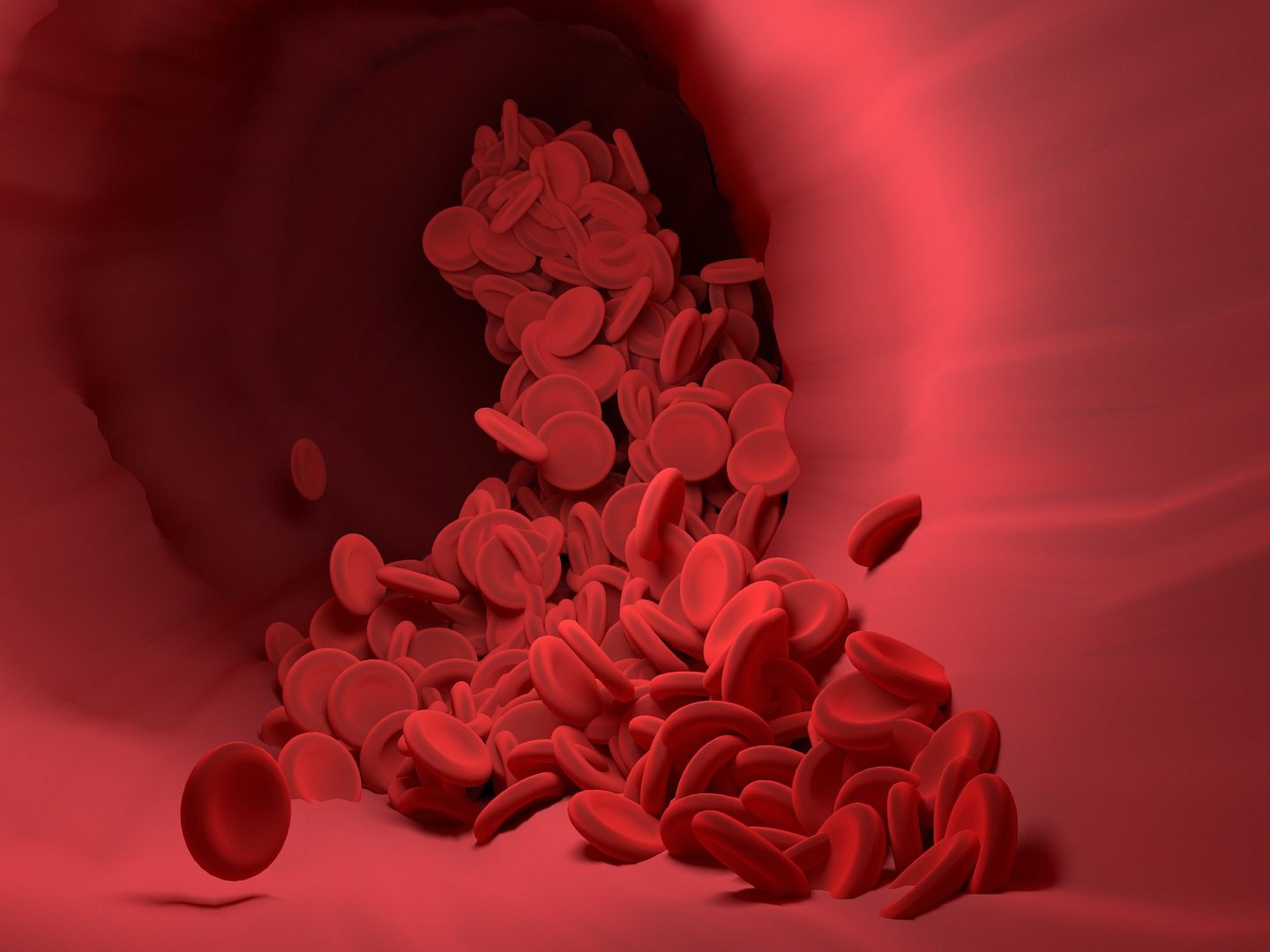 Bei Thrombosen werden Gefäße durch ein Blutgerinnsel verschlossen. Bei Thrombosen werden Gefäße durch ein Blutgerinnsel verschlossen.