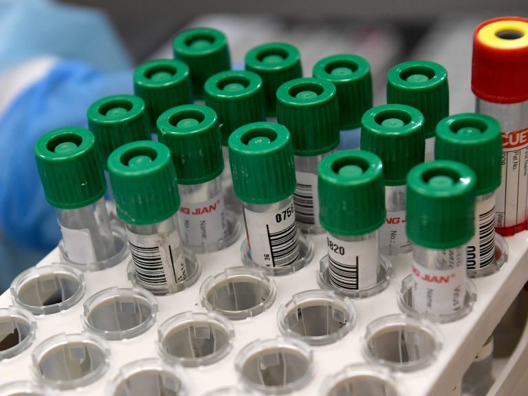 In Österreich wurden am Mittwoch 1.194 Coronavirus-Neuinfektionen gemeldet. In Österreich wurden am Mittwoch 1.194 Coronavirus-Neuinfektionen gemeldet.