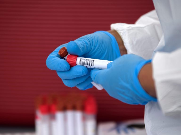 In Niederösterreich wurden am Montag 56 Coronavirus-Neuinfektionen gemeldet. In Niederösterreich wurden am Montag 56 Coronavirus-Neuinfektionen gemeldet.