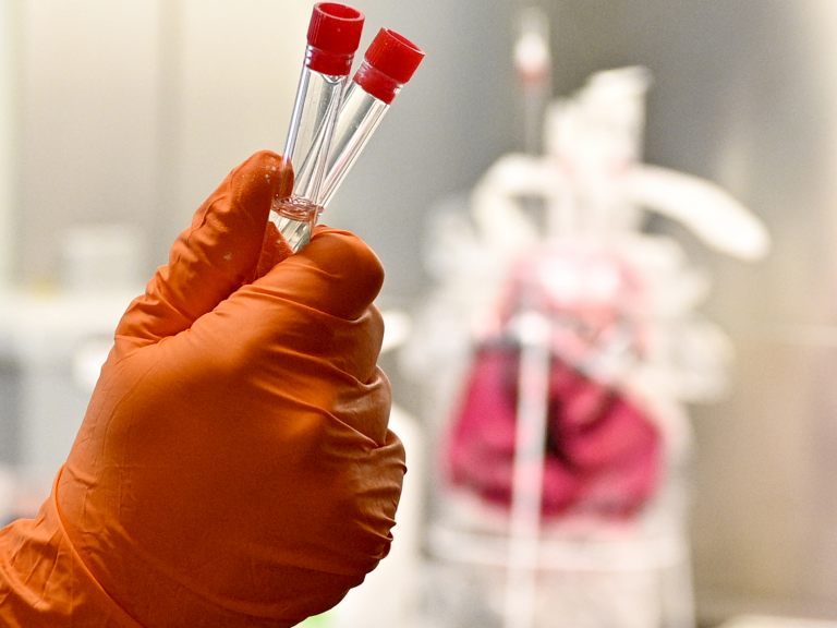 In Niederösterreich wurden am Mittwoch 151 Coronavirus-Neuinfektionen gemeldet. In Niederösterreich wurden am Mittwoch 151 Coronavirus-Neuinfektionen gemeldet.