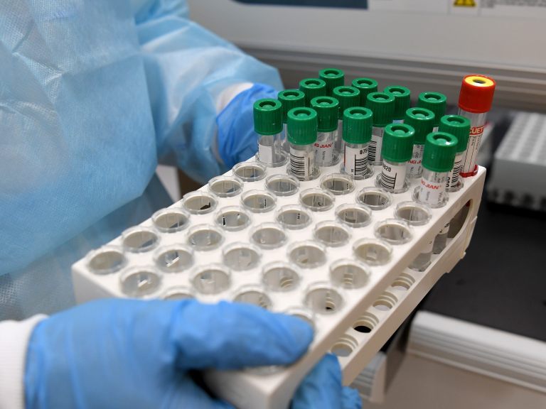 Am Dienstag wurden in Österreich 243 Coronavirus-Neuinfektionen gemeldet. Am Dienstag wurden in Österreich 243 Coronavirus-Neuinfektionen gemeldet.