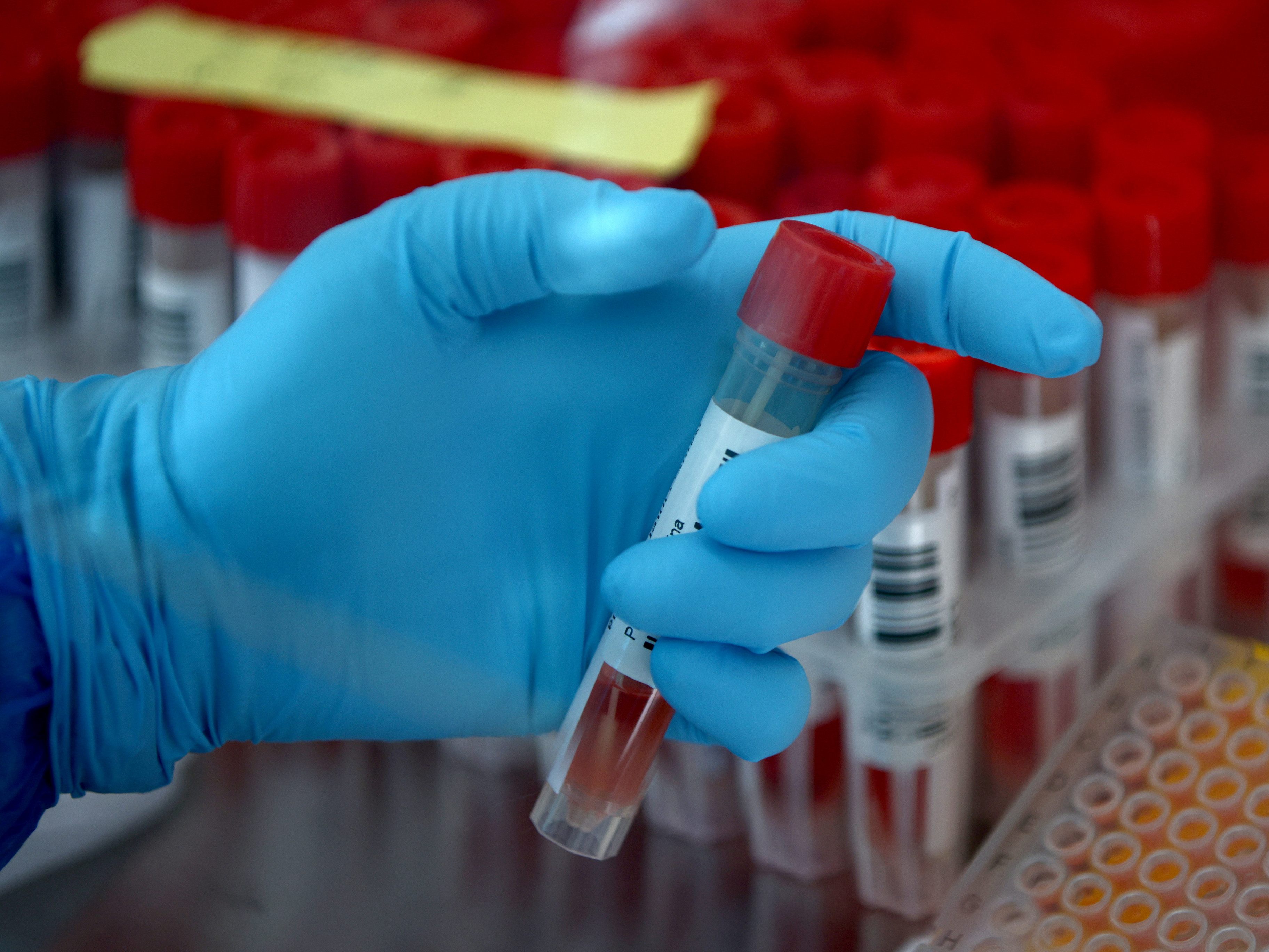Sechs Personen hatten sich mit dem Coronavirus infiziert. Sechs Personen hatten sich mit dem Coronavirus infiziert.
