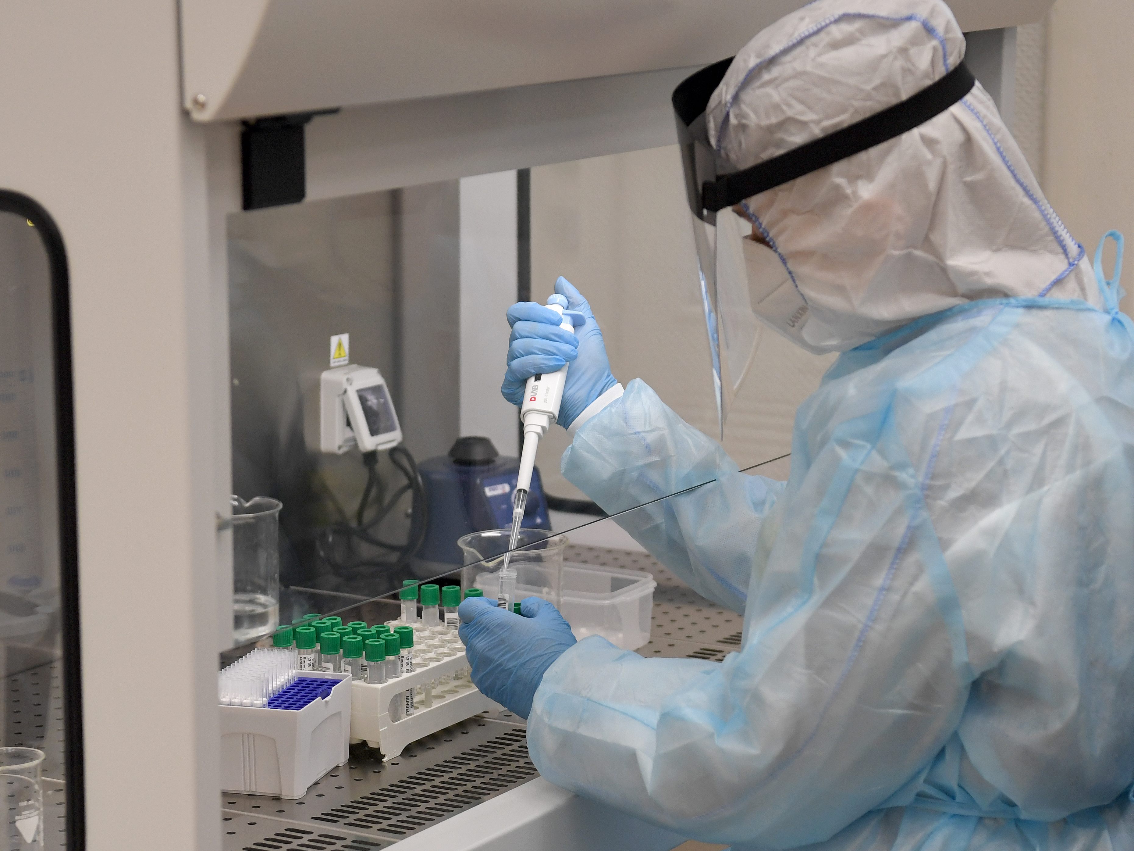 Das Lifebrain Labor wertet die "Alles gurgelt"-Tests aus.