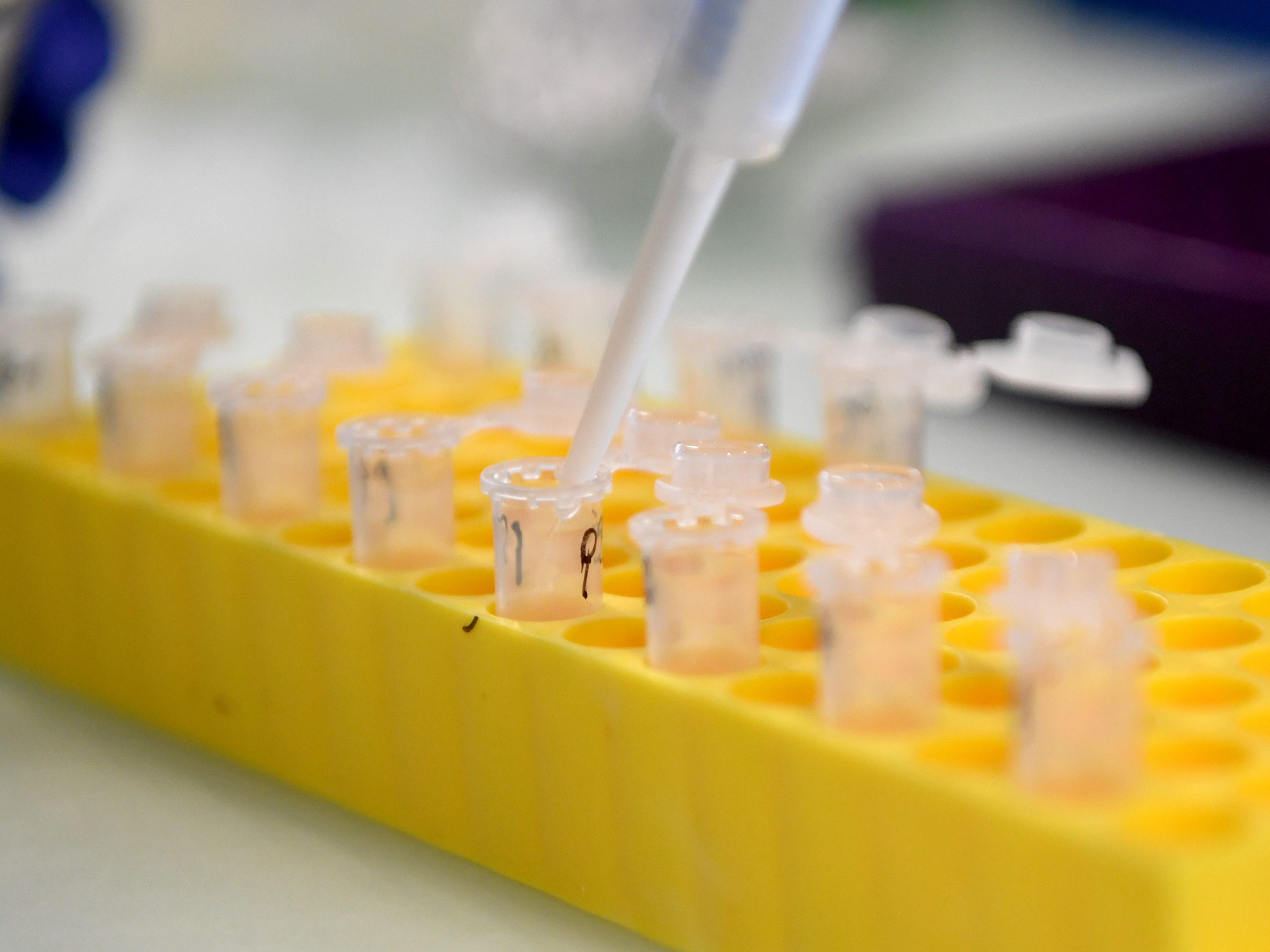 Am Donnerstag gab es in Österreich 452 bestätigte Coronavirus-Neuinfektionen.