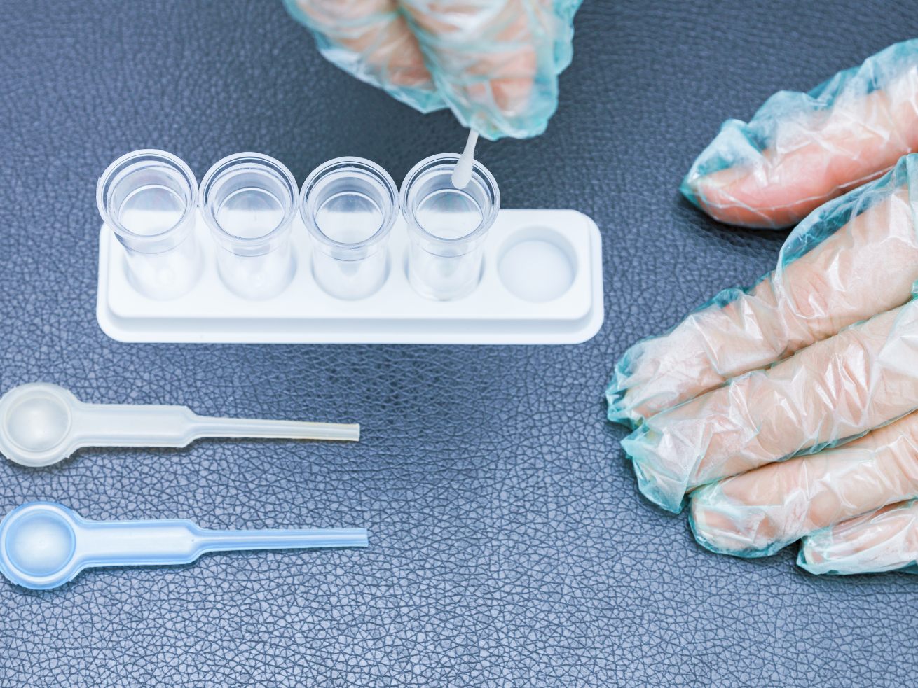 209 Personen sind aktuell mit dem Coronavirus infiziert. 209 Personen sind aktuell mit dem Coronavirus infiziert.
