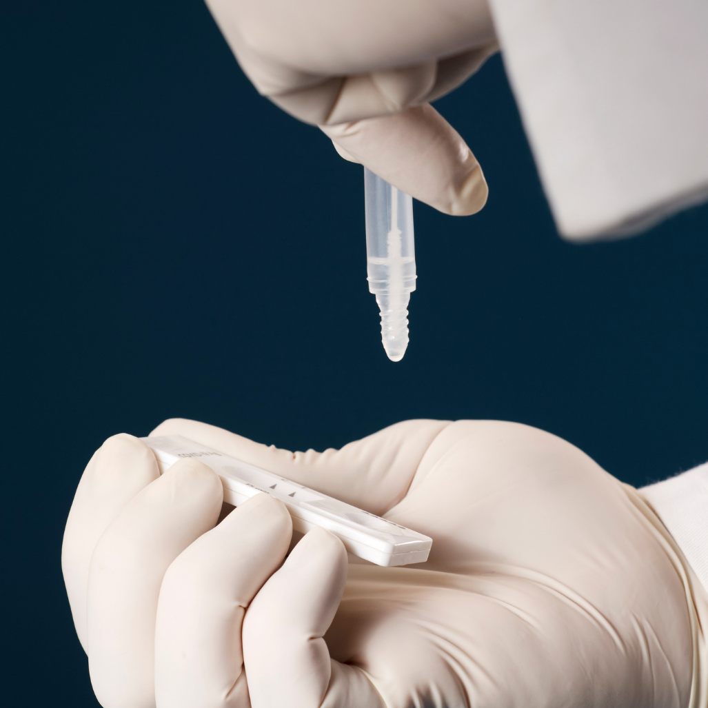 23 Neuinfektionen wurden bis Freitagmittag registriert.