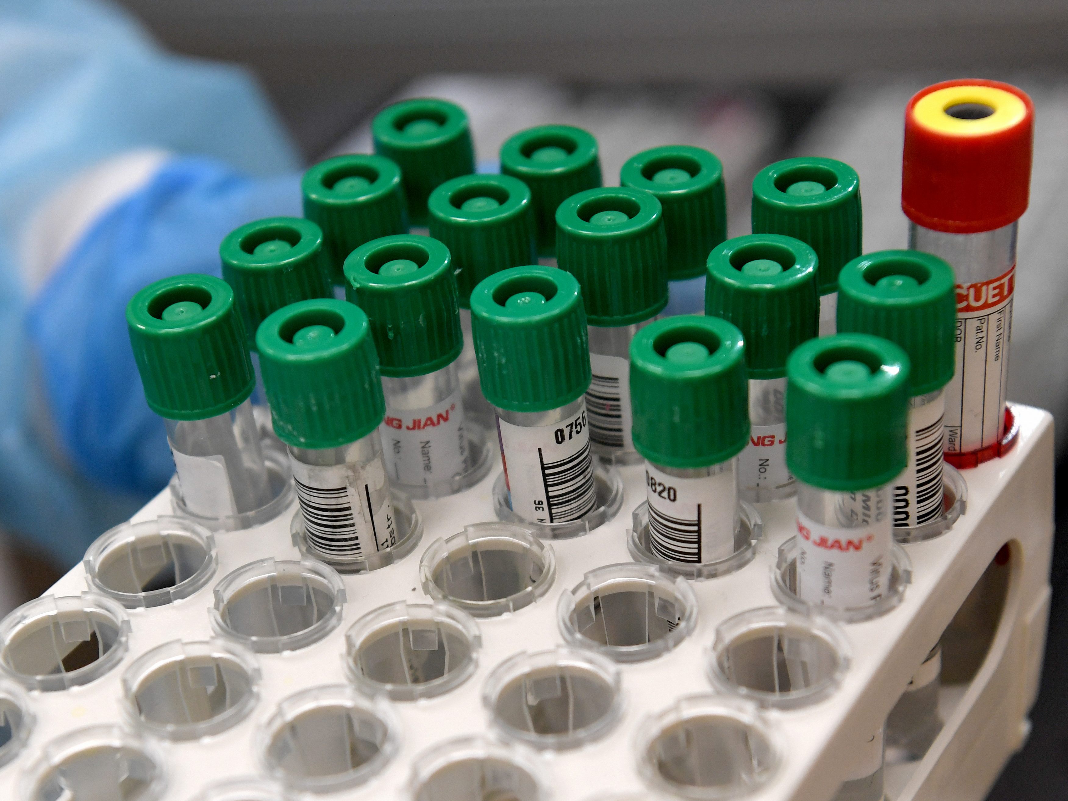 Einige Reiserückkehrer müssen ab nächster Woche einen verpflichtenden PCR-Test machen. Einige Reiserückkehrer müssen ab nächster Woche einen verpflichtenden PCR-Test machen.