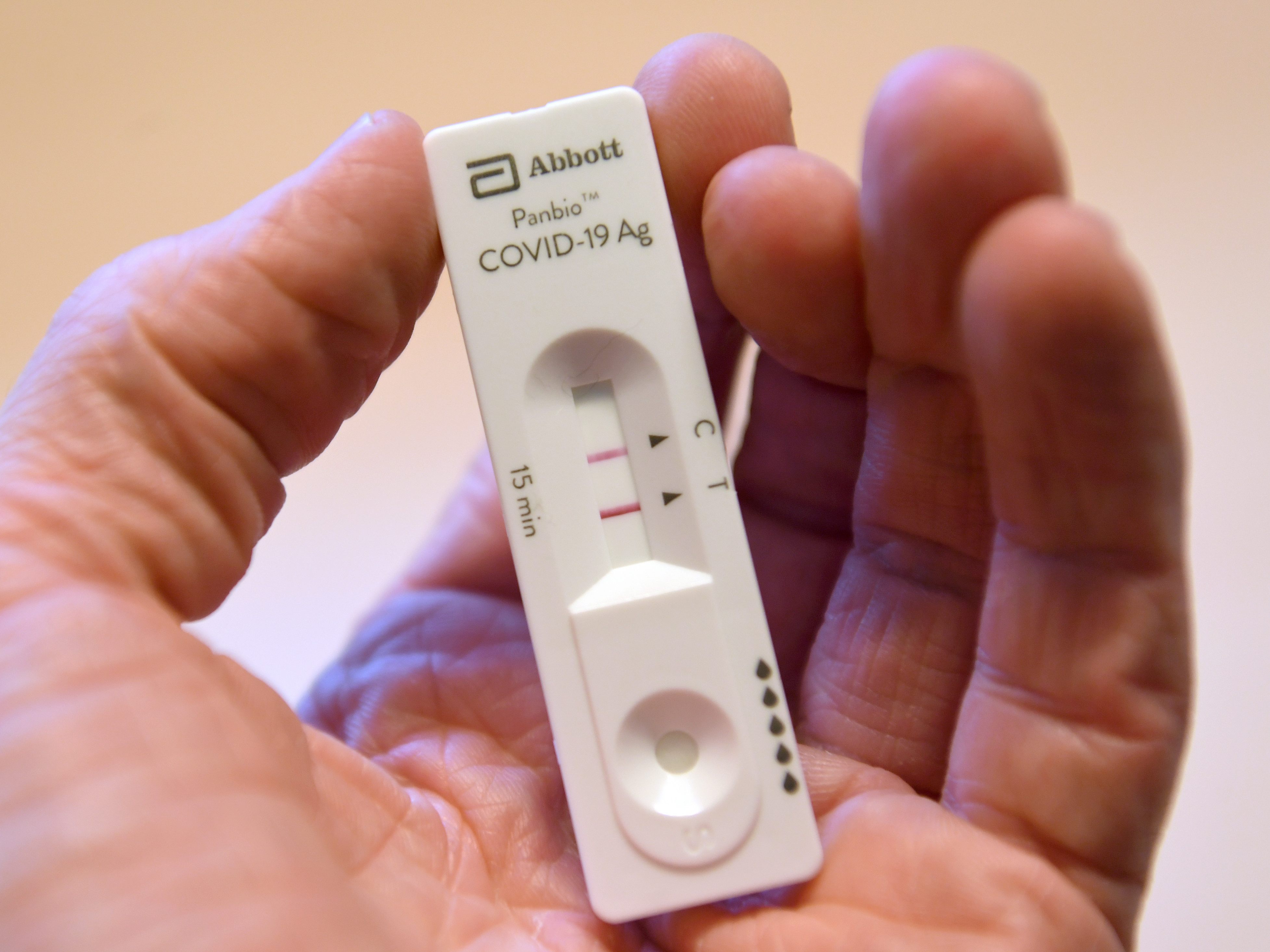 Die Schnelltests sollten jedoch von geschultem Personal durchgeführt werden. Die Schnelltests sollten jedoch von geschultem Personal durchgeführt werden.