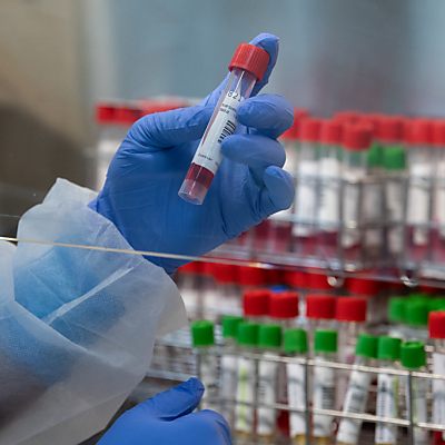 Sieben-Tages-Inzidenz stieg österreichweit auf 41 Fälle