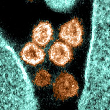 SARS-CoV-2 soll mit zuckerbindende Proteinen bekämpft werden