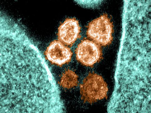 SARS-CoV-2 soll mit zuckerbindende Proteinen bekämpft werden SARS-CoV-2 soll mit zuckerbindende Proteinen bekämpft werden