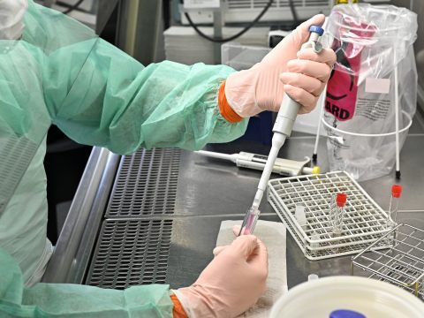 Am Mittwoch wurden in Österreich 1.574 Corona-Neuinfektionen registriert. Am Mittwoch wurden in Österreich 1.574 Corona-Neuinfektionen registriert.