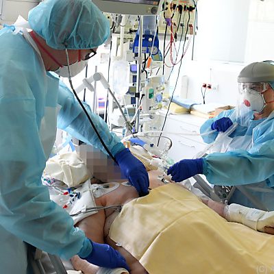 Altersschnitt auf Covid-Inzensivstationen sinkt deutlich