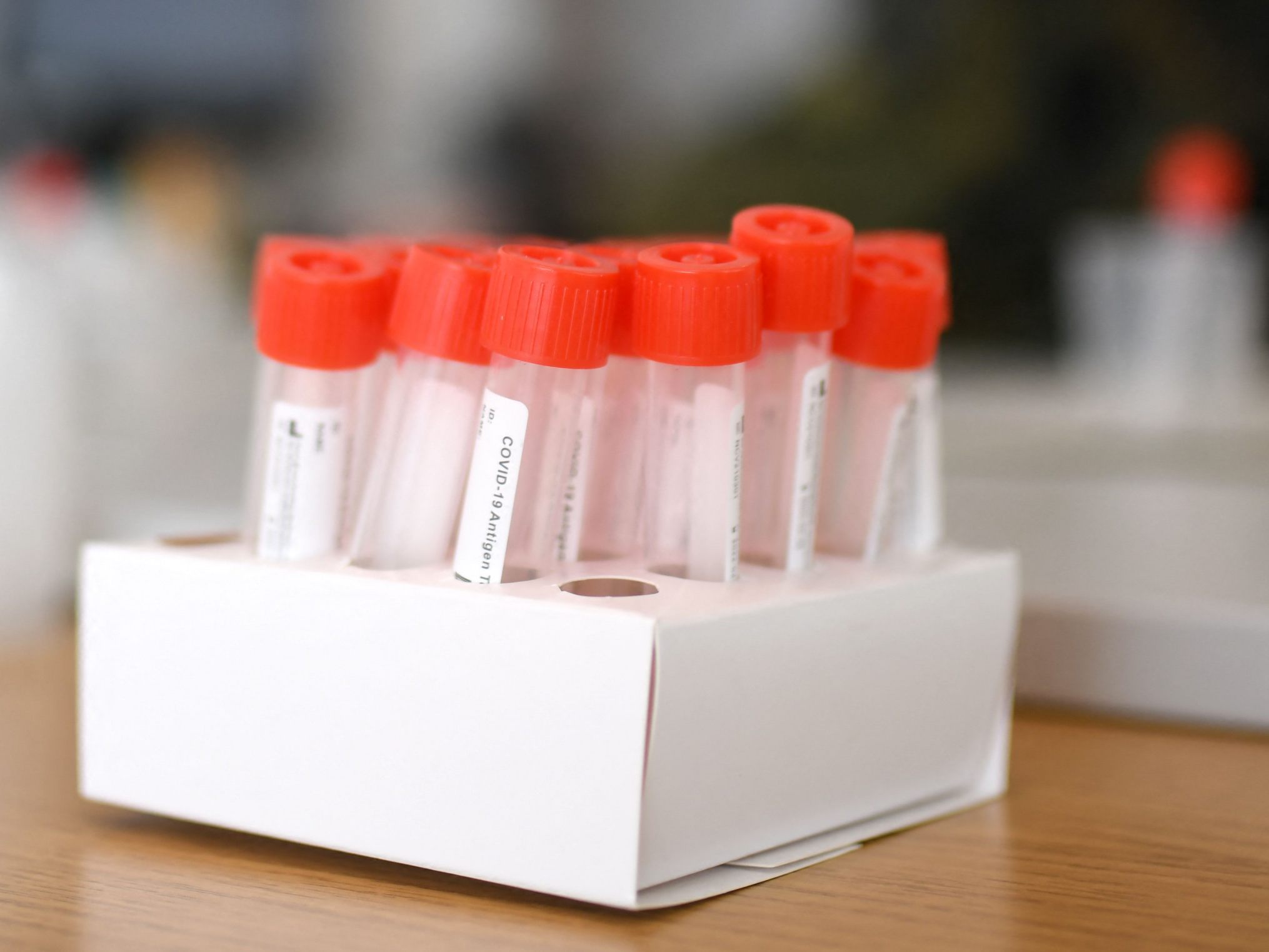 Am Sonntag wurden 1.857 Coronavirus-Neuinfektionen gemeldet. Am Sonntag wurden 1.857 Coronavirus-Neuinfektionen gemeldet.