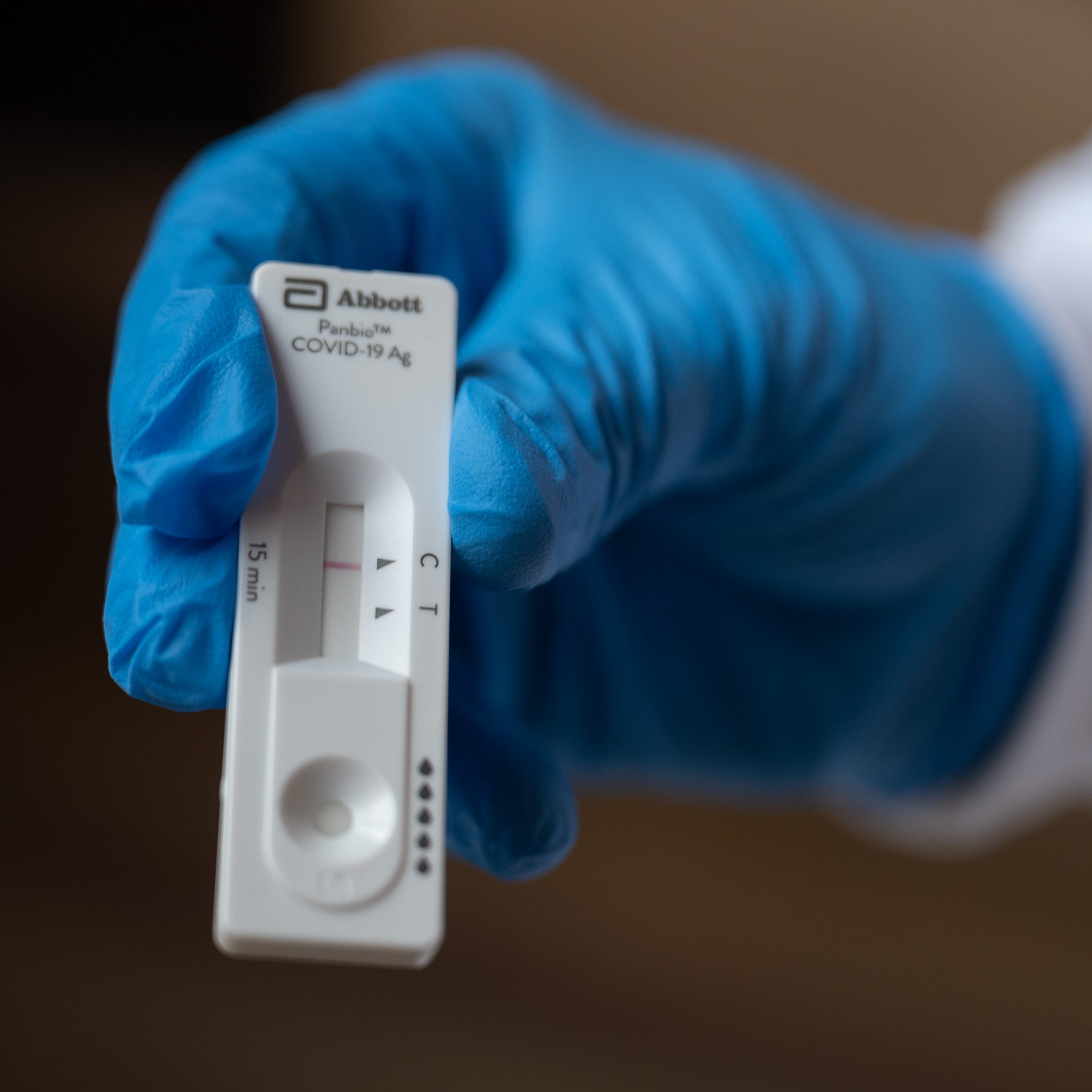 34 Neuinfektionen wurden bis Mittwochmittag registriert.